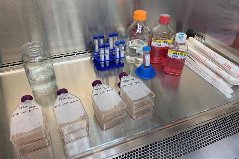 Culture Maintenance of neuroblastoma cells